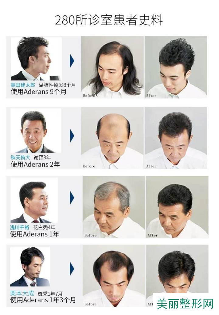 水床垫品牌排行_涂抹式品牌排行_洗发水品牌排行榜