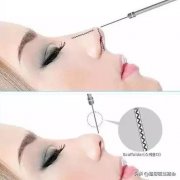 医美项目价格表(医美项目价格表激光脱毛)