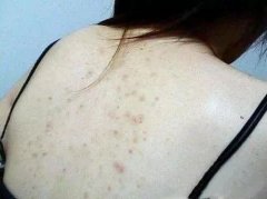 搓澡巾排行榜前十名化妆袋(全国前10的搓澡巾品牌)