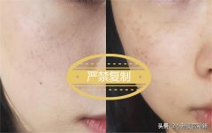 淡斑化妆品排行榜整套的(那个牌子化妆品淡斑)