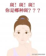 网上祛斑化妆品排行榜(网上祛斑化妆品排行榜前十名)